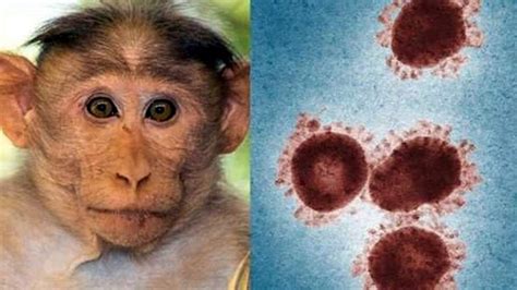 中国现在有猴痘病毒吗
