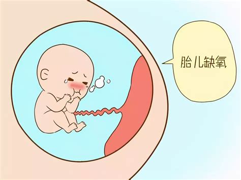 几个月胎儿容易缺氧