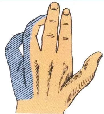 右小手指和无名指发麻警惕四种病