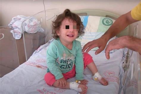 土耳其2岁女童被蛇咬后反把蛇咬死