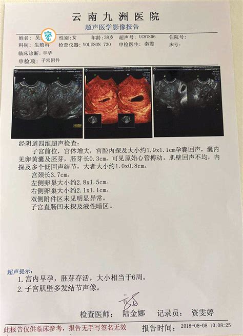 天津医院孕检化验单