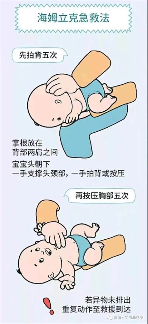 婴儿海姆立克急救法的详细步骤