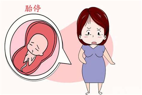 孕13周胎停有什么症状