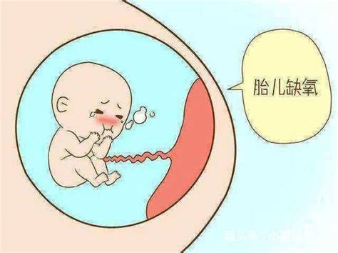 孕17周胎儿缺氧怎么办