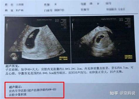 孕34周死胎伤害多大