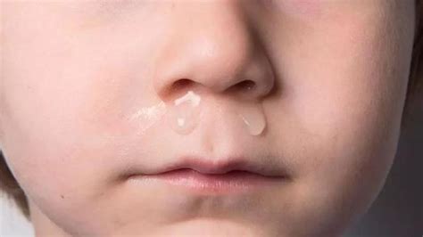 宝宝流鼻涕是什么原因引起的呢