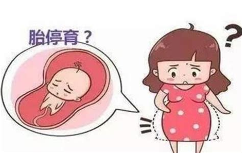 怀孕十周胎停前兆
