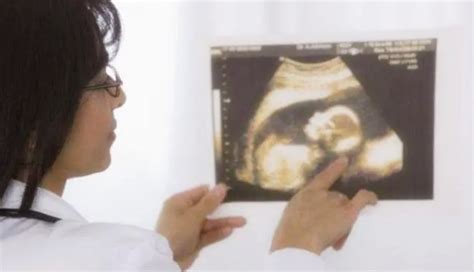 怀孕哪个阶段出现畸形