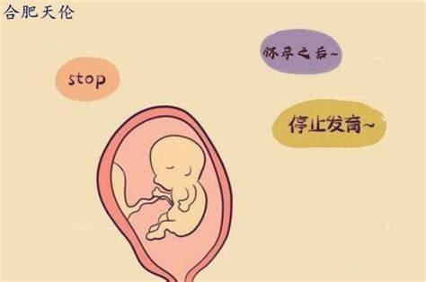 怀孕10多周胎停怎么回事