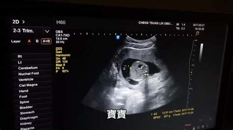 怀孕17周加3天图片