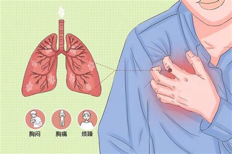 急性胸痛的处理原则有哪些