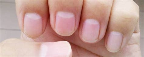 指甲盖的白色月牙代表什么