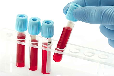 检测机构化验血多少钱