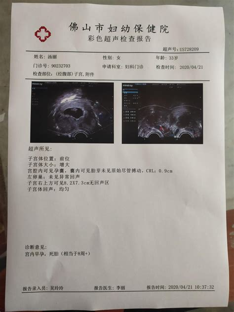 深圳医院b超单图片