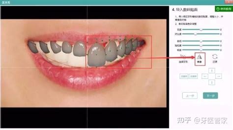 牙科美学设计软件