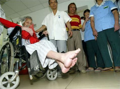 百岁裹脚老人小脚只剩一个脚趾