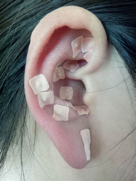 耳疗的手法教程