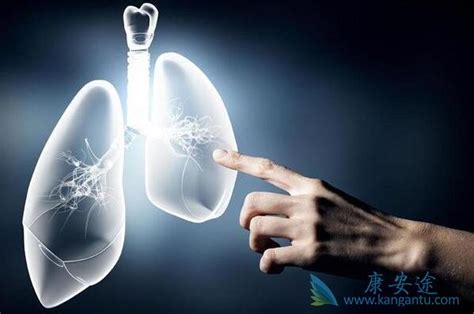 肺癌的最佳治疗方案
