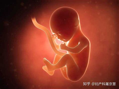 胎儿几月容易脐带绕颈