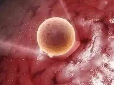 胚胎存活是成功了吗