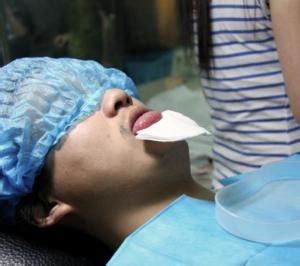 舌头分两半手术过程