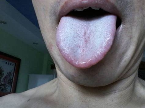 舌苔干涩什么原因