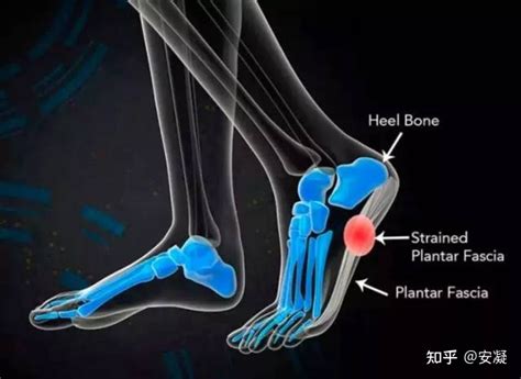 莫名脚痛是什么原因