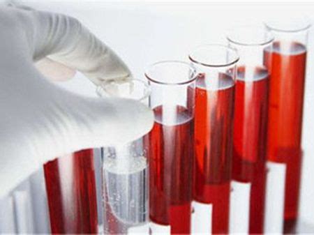血液毒物检测长沙医院可以做