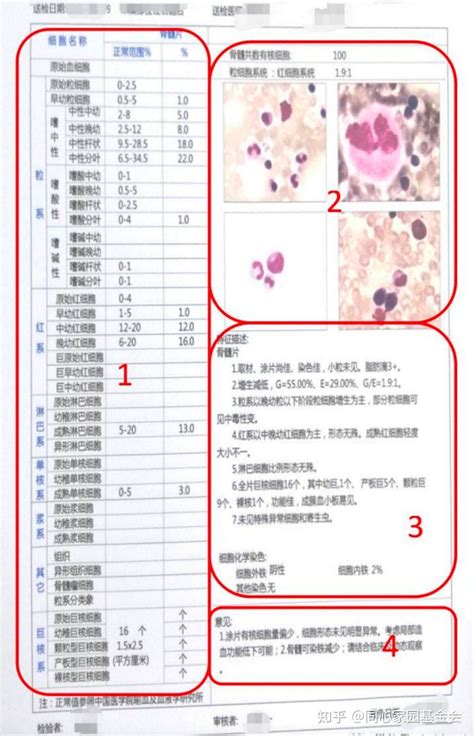 血细胞分析是查什么病