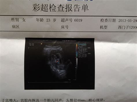 襄阳中医医院胎儿彩超多少钱
