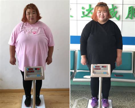140斤胖女孩减肥3个月