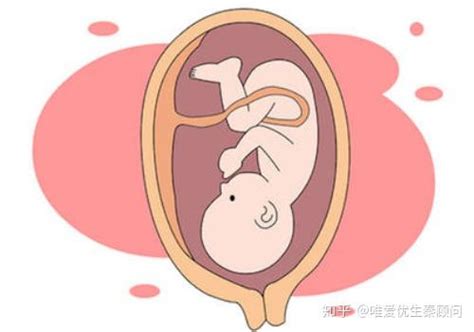 34周终止妊娠胎儿能存活吗