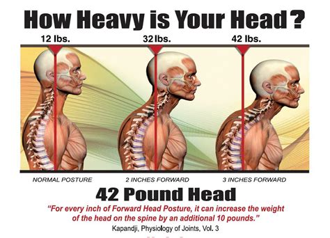head posture