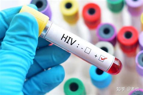 hiv抗体为什么不是0
