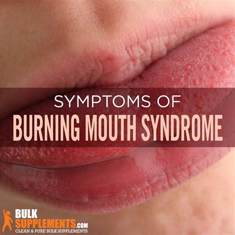 mouth syndrome