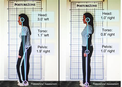 posturezone解析